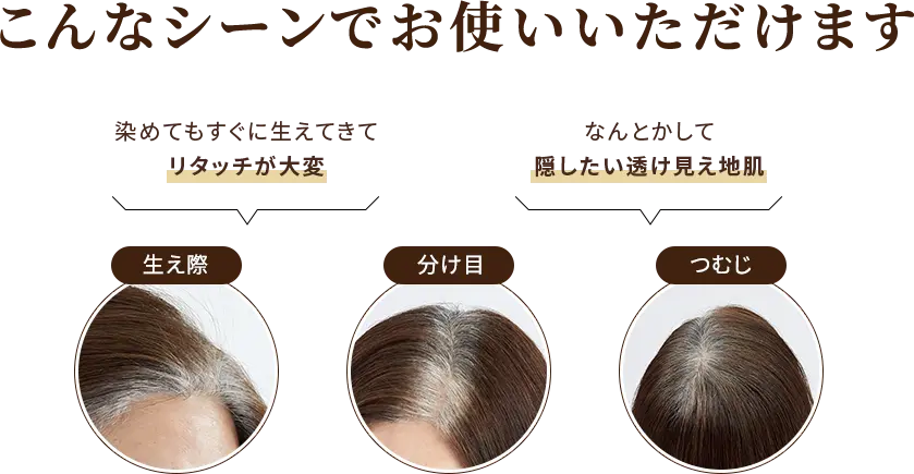 こんなシーンでお使いいただけます ・染めてもすぐに生えてきてリタッチが大変 ・なんとかして隠したい透け見え地肌